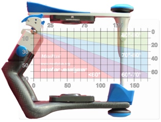 Vector-Analyzer an der Artikulatorachse angelegt